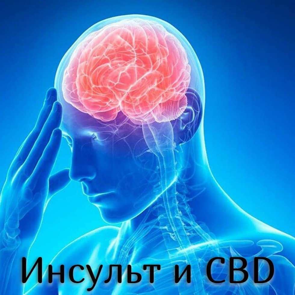 STROKE AND CBD buy cbd oil in Russia in Moscow
